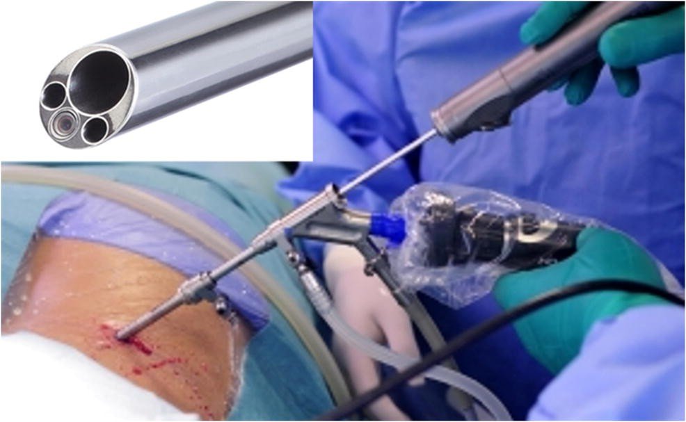 264_2018_4283_Fig2_HTML