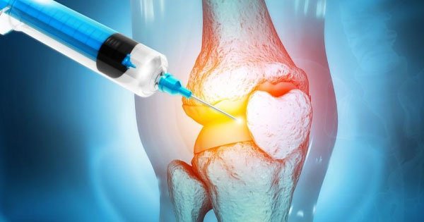 PRP-therapy-for-Knee-joint-pain