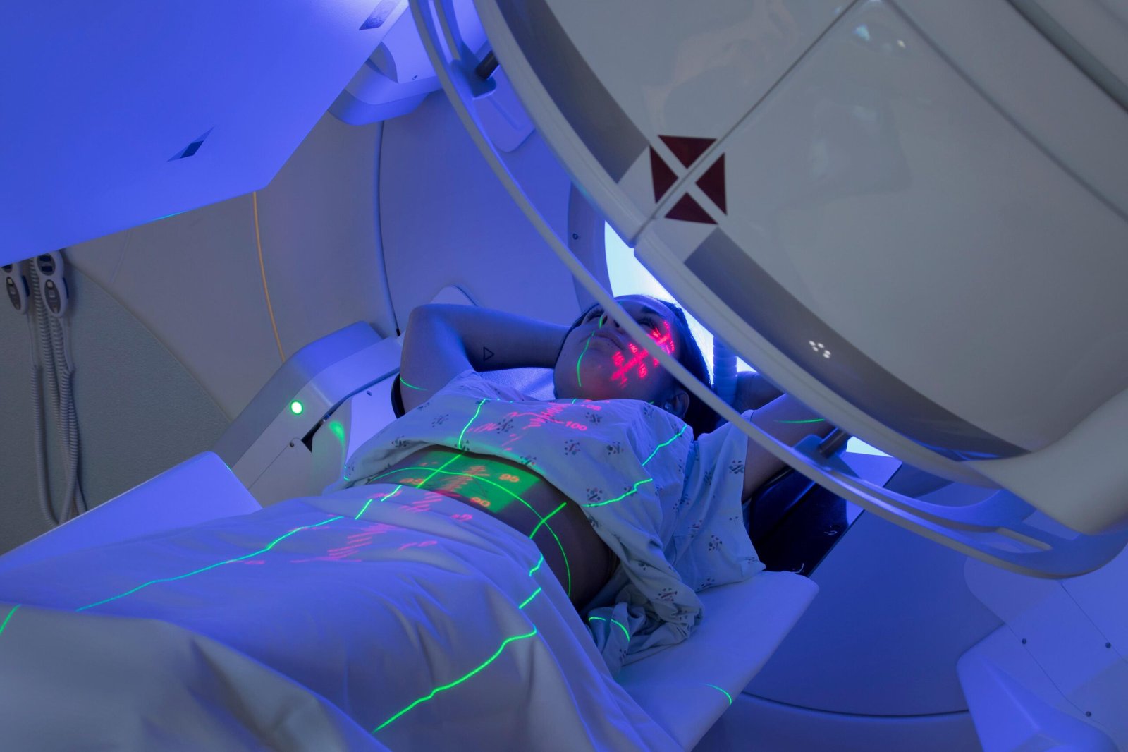 radiation therapy for cancer